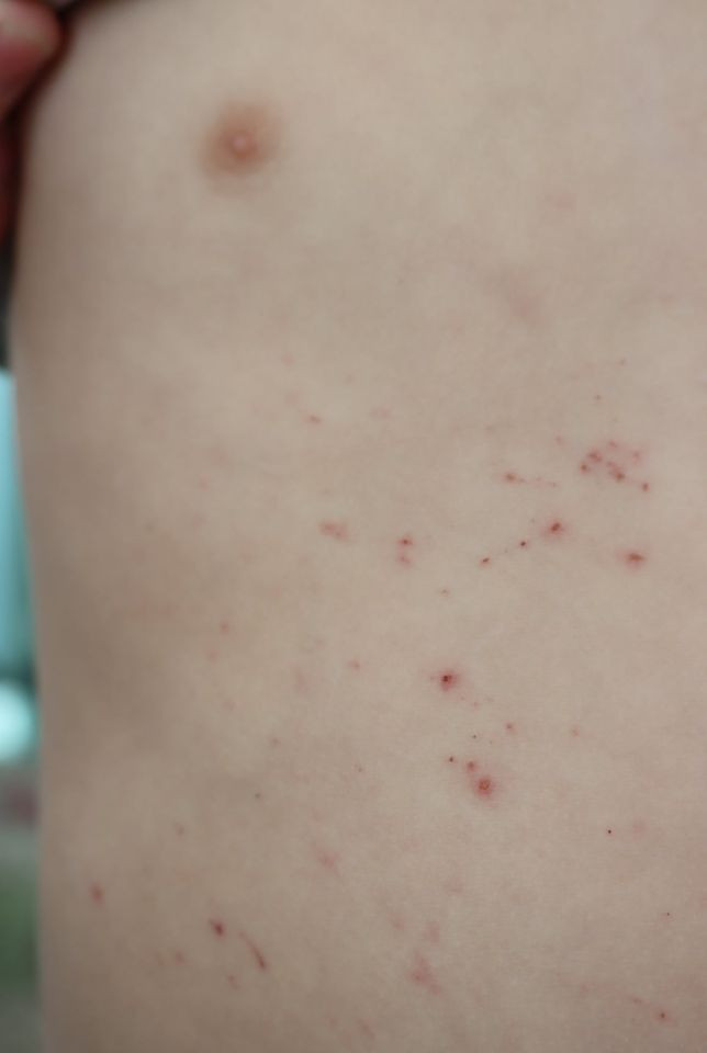 Нийслэлийн ... дугаар цэцэрлэгт үзлэг хийлээ