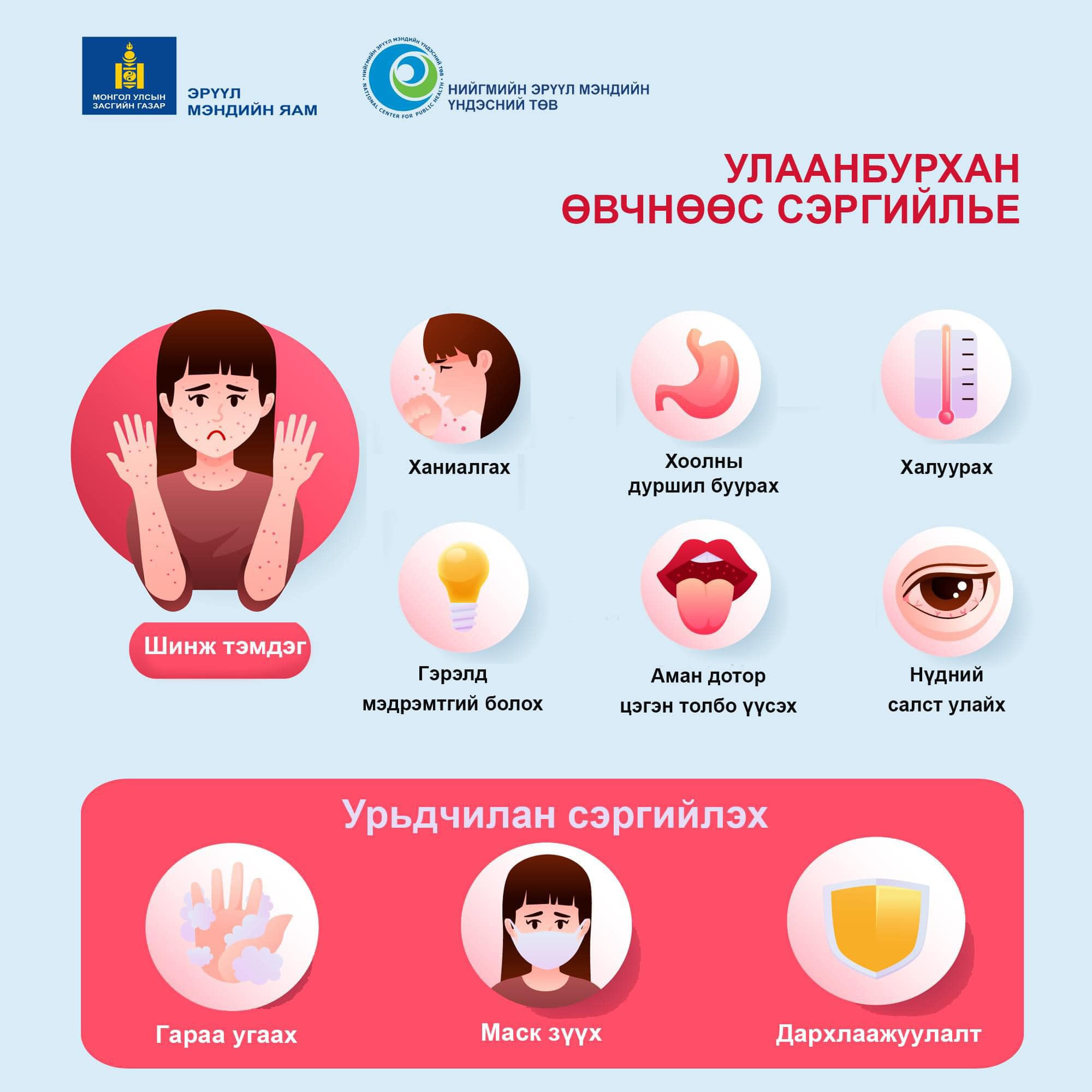 Улаанбурхан өвчнөөс сэргийлье!!