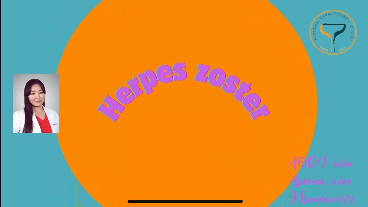 👩‍⚕️ЭМЧ ЗӨВЛӨЖ БАЙНА👇👇👇: №8 🔰 АӨСҮТ-ийн Клиникийн I-р тасгийн их эмч Э.Баасанхүү "Бүслүүр үлд” өвчний талаар мэдээлэл хүргэж байна.