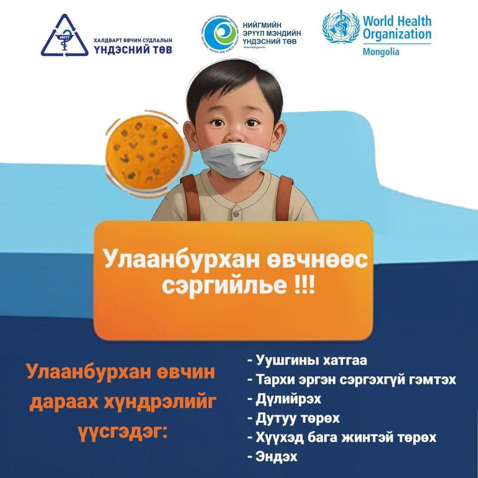 Улаанбурхан өвчнөөс сэргийлье!!!