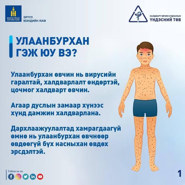 УЛААНБУРХАН ӨВЧНӨӨС УРЬДЧИЛАН СЭРГИЙЛЬЕ!
