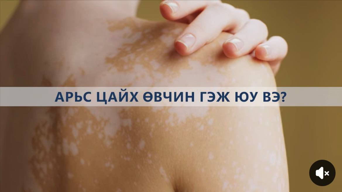 🎙👩‍⚕️ #АӨСҮТ-ийн ЭГЗНСТасгийн их эмч И.Мөнхзаяа "АРЬС ЦАЙХ" сэдвээр мэдээлэл хүргэж байна. 🙌