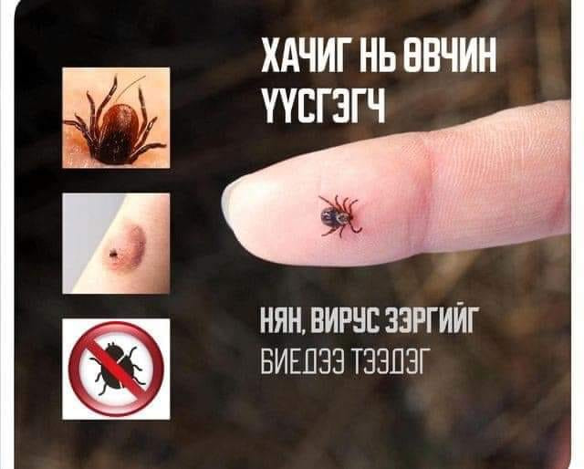 Хачигт халдвараас сэргийлэе❗