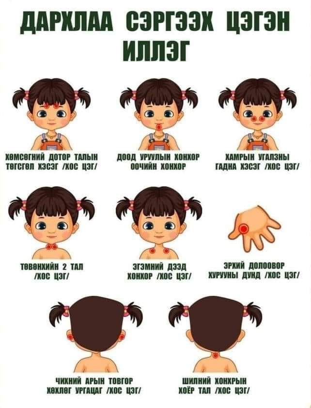 📌 Томуу, томуу төст өвчний үед уламжлалт аргаар хийх дархлаа сэргээх цэгэн иллэгийг дарааллаар нь хийж, дархлаагаа сэргээгээрэй✅