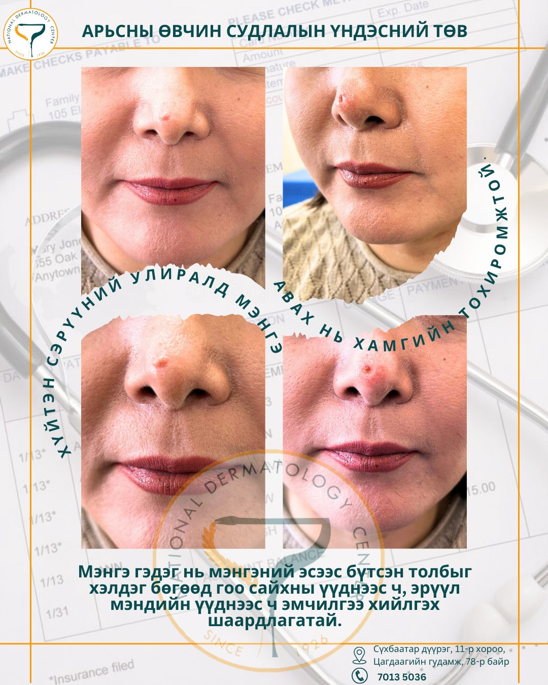 Мэнгэ гэж юу вэ?